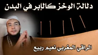 خطييير جدااا دلالة الإحساس بالوخز كالإبر في البدن الراقي المغربي نعيم ربيع 