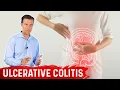 Download Lagu What is Ulcerative Colitis? – Causes, Symptoms \u0026 Treatment by Dr.Berg