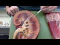Anatomy II Episode 8 Urinary System - TEACHER T
