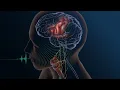 Speech From Brain Signals
