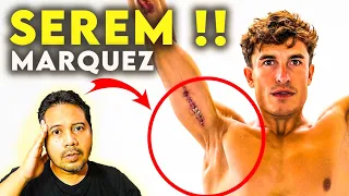 BIKIN GEGER ‼️CEDERA BAHU TERBARU MARQUEZ….LENGAN JADI MENGECIL 😱