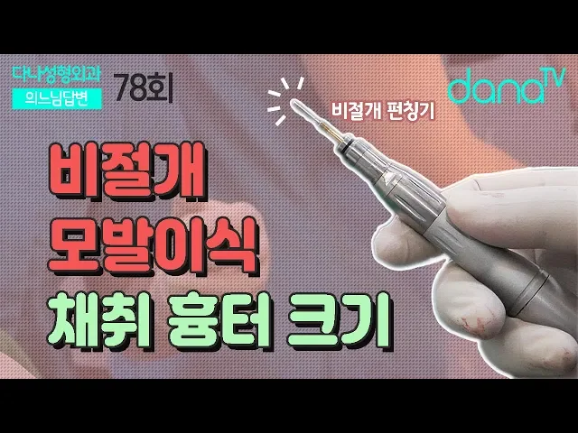 의느님답변📂ㅣ비절개 모발이식 모낭 채취 흉터 크기의 비밀 의느님답변 78회