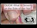 Pedicure Tutorial What Mimics Ingrown Toenail Pain Pro Tools Available on My Online Store