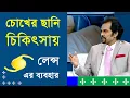 Download Lagu The use of lenses in the treatment of cataracts Prof. Dr. Harun Ur Rashid | Dhaka Eye Care Hospital