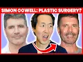 SIMON COWELL Plastic Surgery Transformation - Cosmetic Surgeon Reacts