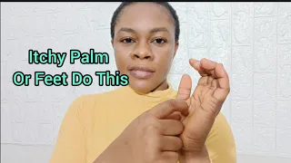 For Itchy Palm or Foot do this immediately hi you will be shocked