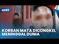 Download Lagu TRAGIS! KORBAN MATA DICONGKEL di Bogor Meninggal Dunia, sang Kakak Ungkap Penyebabnya