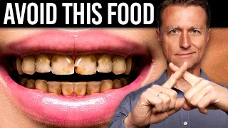 Download The Worst Food for Your Teeth Is NOT SUGAR MP3