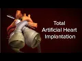 Download Lagu Medical Animation: Total Artificial Heart Implantation | Cincinnati Children's