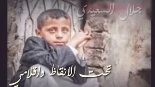 انا طفل يمني ضامي حالات حزينه عن اطفال اليمن روعه 