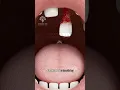 Download Lagu What Happens If You Swallow a Tooth 🦷 #short #viralvideo - Creativelearning3d