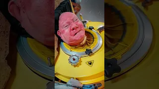 راجل داخل جهاز التنفس لمده 70عام 