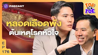 คราบไขมัน (plaque) เกิดขึ้นได้อย่างไร และมีกี่ประเภท