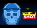 What Does it Actually Feel Like to be Shot in the Head