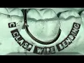 Download Lagu #CClaspWireBending C Clasp wire bending step by step