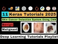 Building Skin Cancer Detection System Using CNN Deep Learning Skin Cancer Diagnosis Using Python