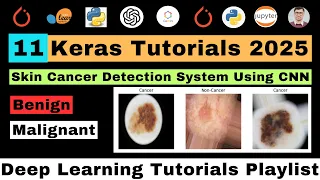Building Skin Cancer Detection System Using CNN Deep Learning Skin Cancer Diagnosis Using Python