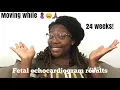 IVF Pregnancy 24 Weeks Moving and Echocardiogram