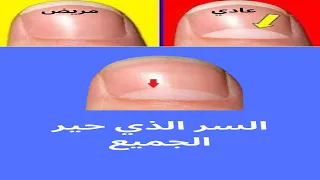 ما سر وجود هذا الهلال الأبيض على الأظافر 