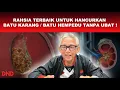 Lagu RAHSIA TERBAIK UNTUK HANCURKAN BATU KARANG \u0026 BATU HEMPEDU TANPA UBAT!