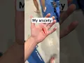 The Real Reason Gymnasts Wear Grips