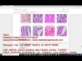 Histopathological Images for Prediction of Breast Cancer Using python code Breast cancer