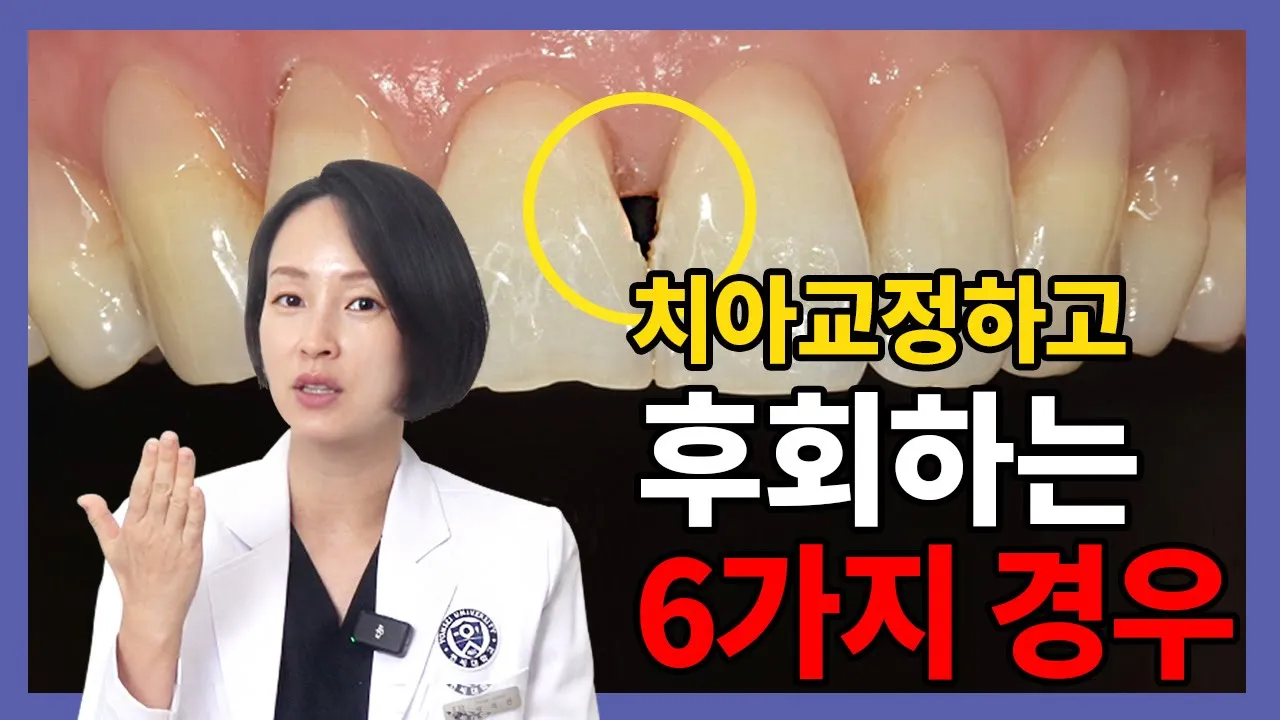 ()치아교정 후 후회하는 경우. 교정학박사가 알려드립니다. 교정 고민중이신 분들 꼭 보세요❗