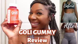 I TRIED APPLE CIDER VINEGAR PILLS FOR A WEEK FOR WEIGHTLOSS INSANE RESULTS