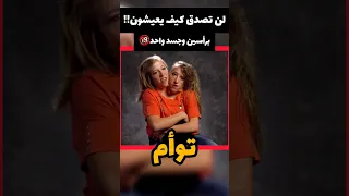 رأسين في جسد واحد أغرب ما ستراه عيناك Shorts Viral 