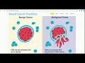 Machine Learning Project Breast Cancer Detection Using Python Django and Machine Learning