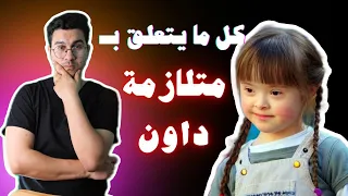 متلازمة داون الأعرض والأسباب وطرق العلاج العمر المتوقع للطفل المصاب Down Syndrome 