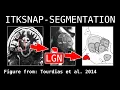 Tutorial - Intro to segmentation in ITKSNAP