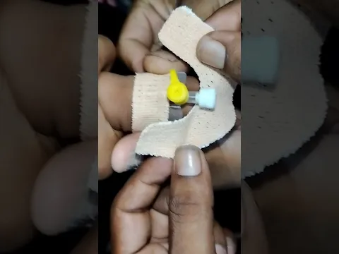 Cannulation.. new.. video.. part 1115 #shorts #cannula #trending