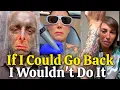 Laser Tattoo Removal The Pain Cost What No One Tells You
