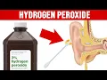 9 Unexpected Benefits of 3 Food Grade Hydrogen Peroxide