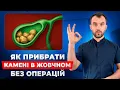 Download Lagu Камені в жовчному міхурі. Як прибрати без лікарів і операцій