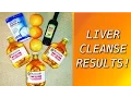 My Liver Gallbladder Cleanse Experience from Andreas Moritz