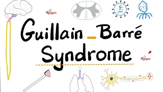Guillain-Barré Syndrome - Acute Inflammatory Demyelinating Polyradiculoneuropathy “AIDP”- Neurology