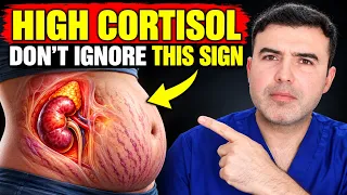 High Cortisol Changes Your FACE and BODY! (6 Warning Signs Most People Miss)