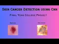 Skin Cancer Detection Deep Learning CNN Machine Learning Image Processing Python Project