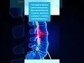 Is It a Herniated Disc Know the Signs Get Natural Relief in Yorktown VA