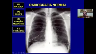 Introdução ao Raio X de tórax + Síndromes pleuropulmonares