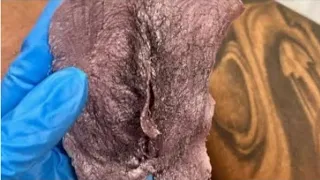 brazilian wax experience pain level u0026 honest thoughts my first