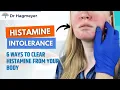 How to Clear Histamine - How To Get Rid of Histamine in 6 Easy Steps Dr Richard Hagmeyer