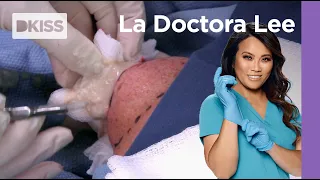 La doctora Lee le extirpa un bulto del hombro