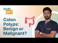 Are Colon Polyps Cancerous Dr Raghu D K