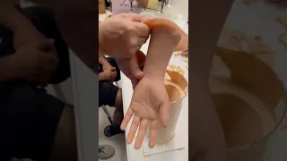 Severed TC 5130 Siliconehand Casting 