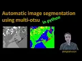 115 - Auto segmentation using multi-otsu