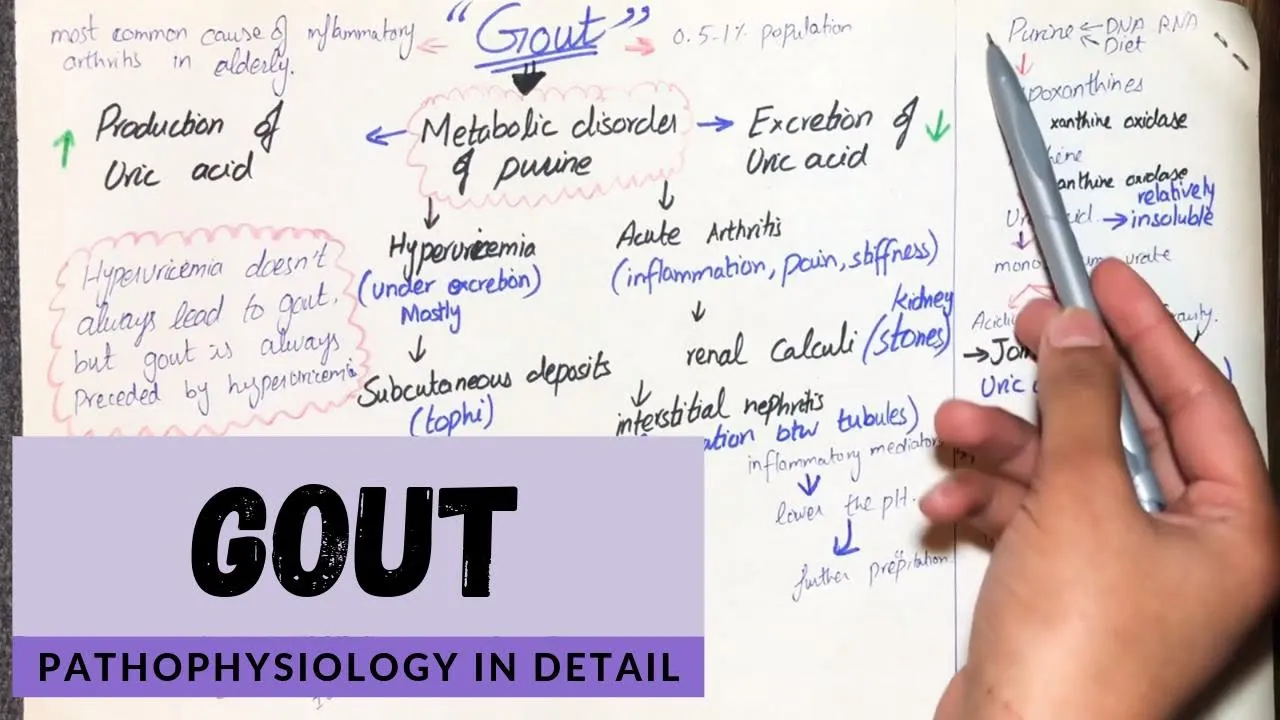Gout - Pathophysiology in detail. (Hindi/Urdu)