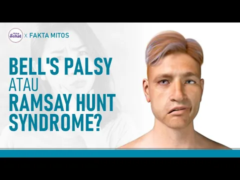 Gejalanya Mirip, Apa Bedanya Bell's Palsy dengan Ramsay Hunt Syndrome?